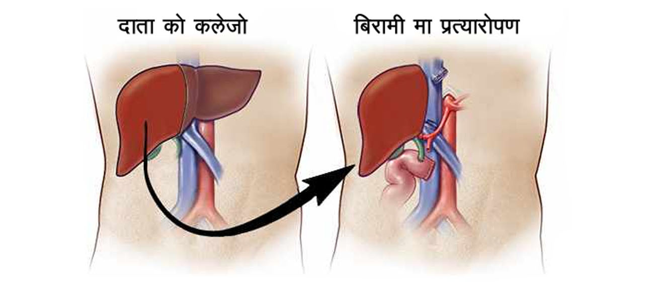 प्रतीकात्मक तस्बिर।