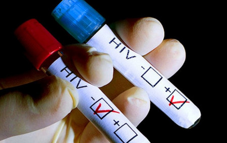 २ लाख जनामा एचआइभी परीक्षण गरिएकोमा १५ सय बढीलाई संक्रमण पुष्टि